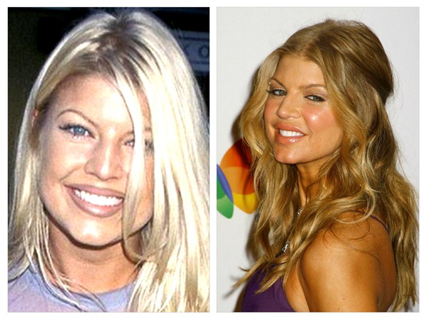 Fergie