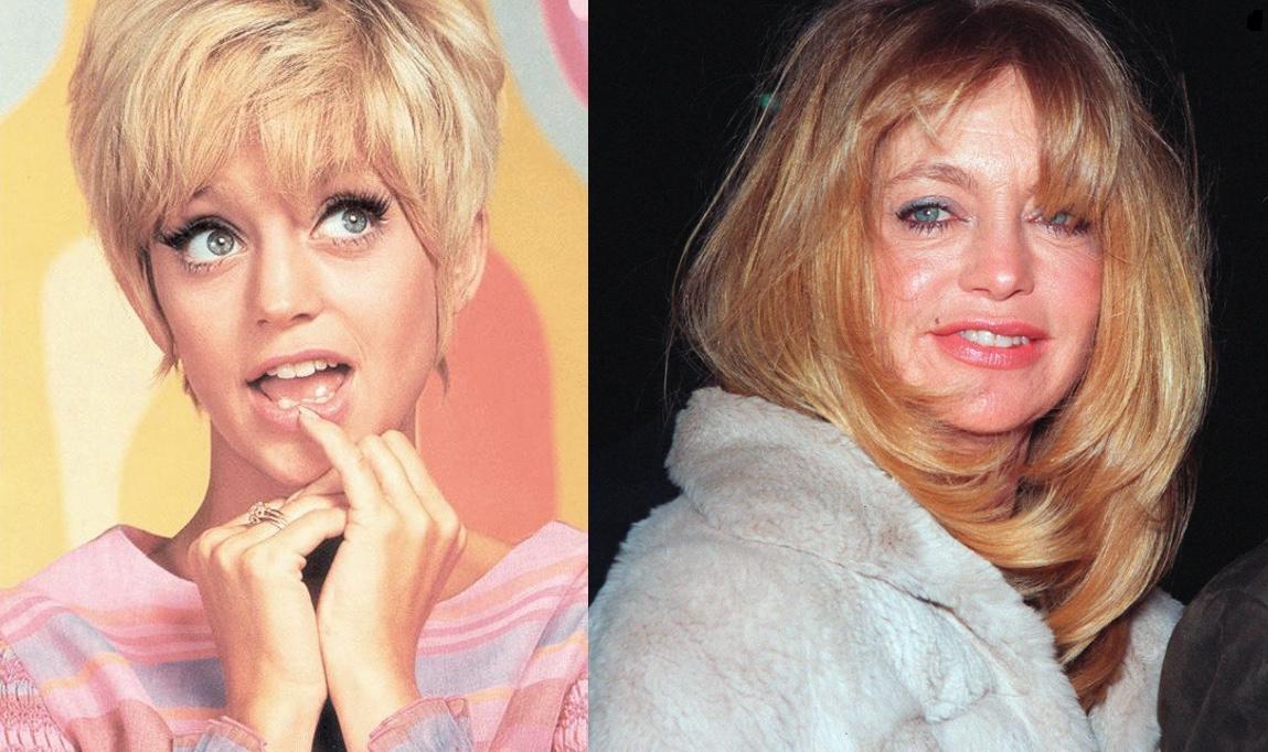 Goldie Hawn