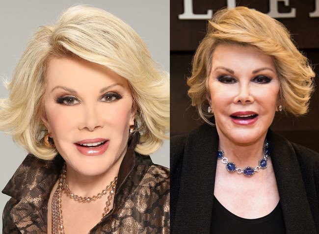 Joan Rivers