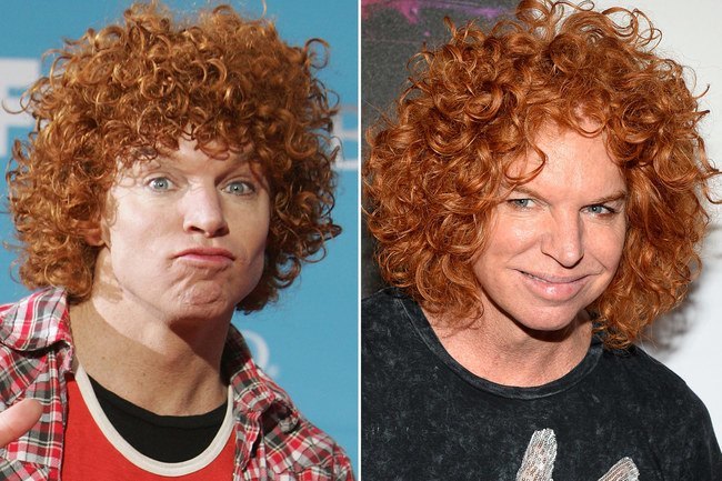 Carrot Top